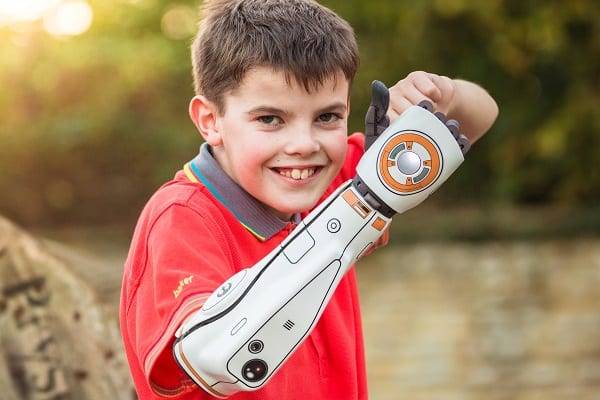 Smiling boy with a Open Bionics Hero arm.